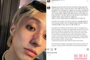 韩国首位出柜男歌手holland 被骂是肮脏的gay怎么回事
