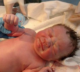 新生儿手握节育环出生是真的吗？背后的真相是这样……